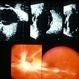 Pre-Retinal Fibrous Proliferative Membrane